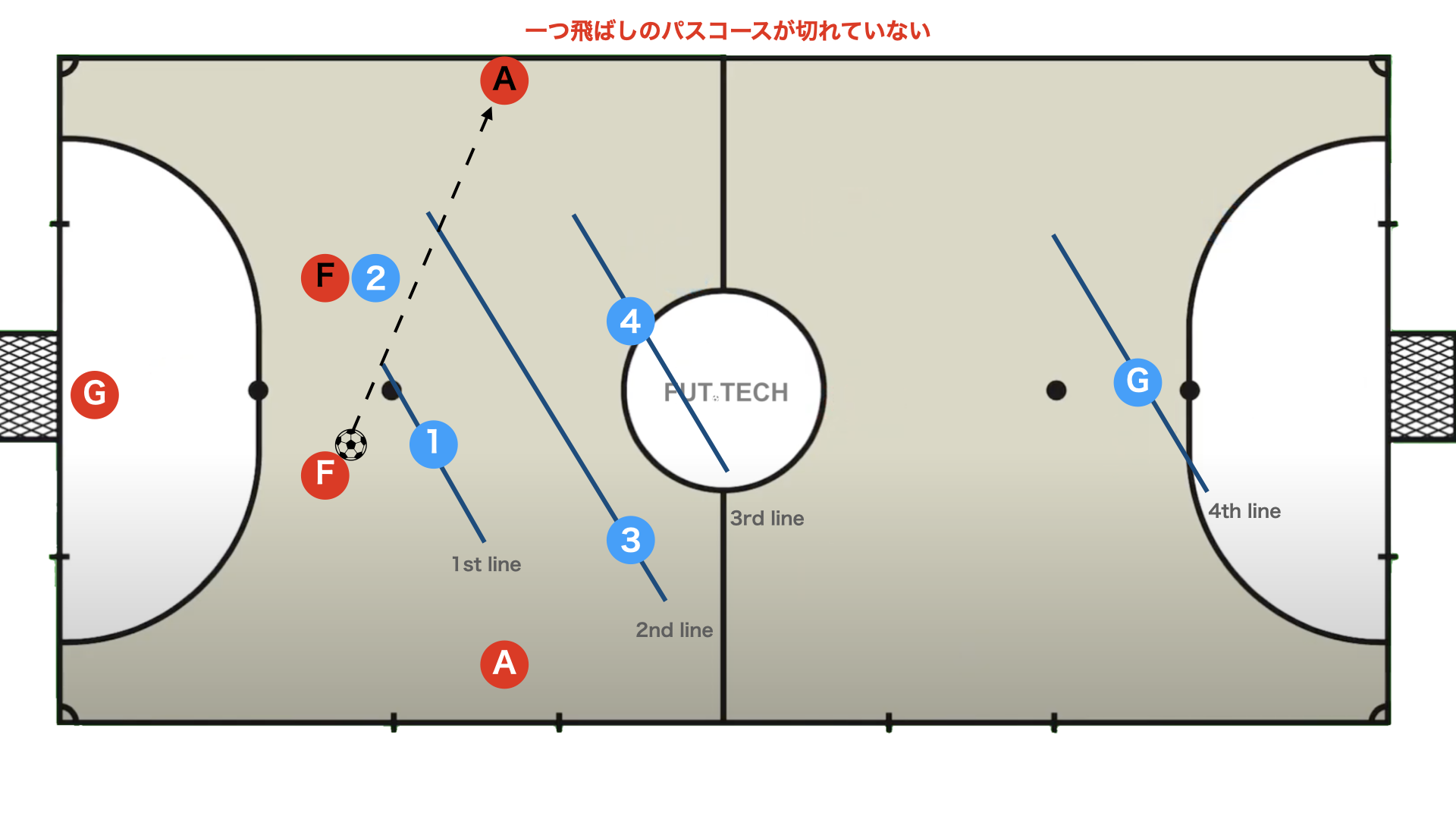 悪い例② 一つ飛ばしのパスを許容